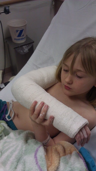 plaster cast