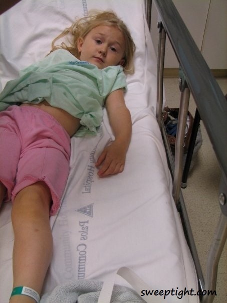 broken arm
