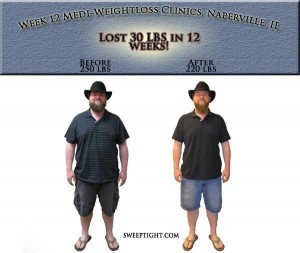 Before and after weight loss picture