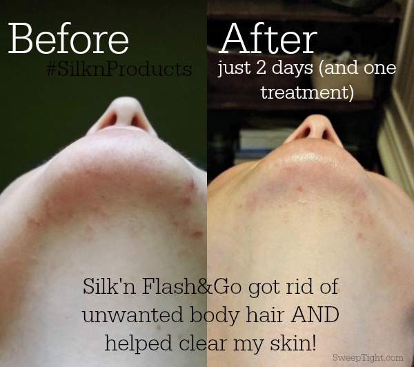 Facial hair on this lady no more! #SilknProducts #sponsored #MC