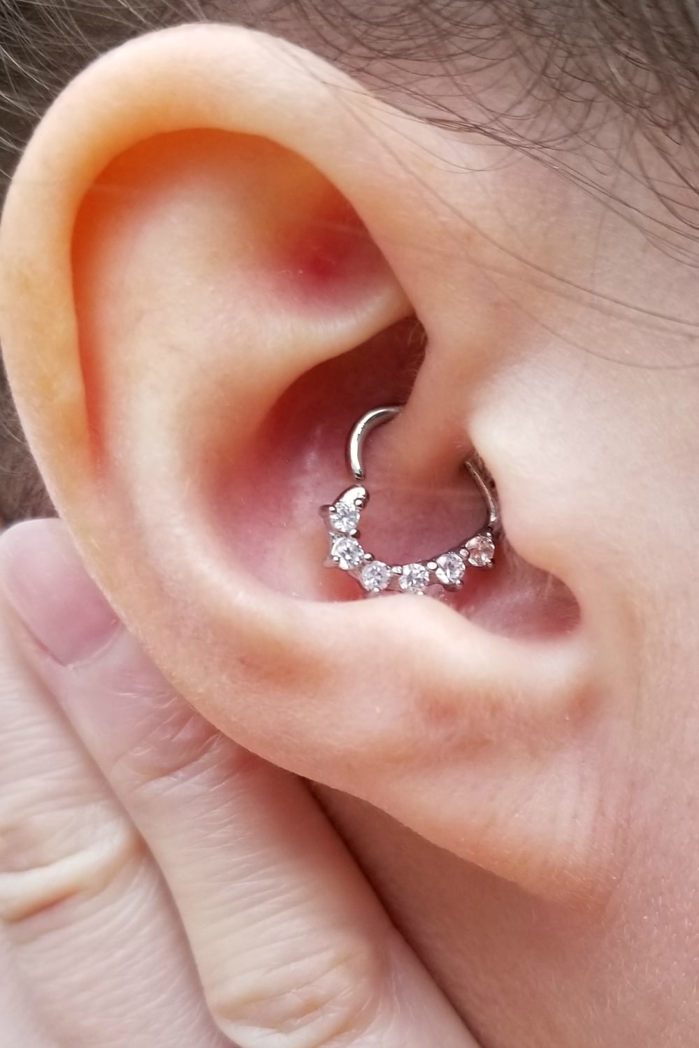 A Piercing for Headache Relief: 2 Years Later - Migraine Piercing - Daith Piercing results
